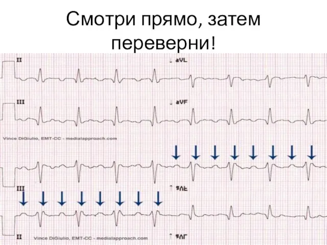 Смотри прямо, затем переверни!