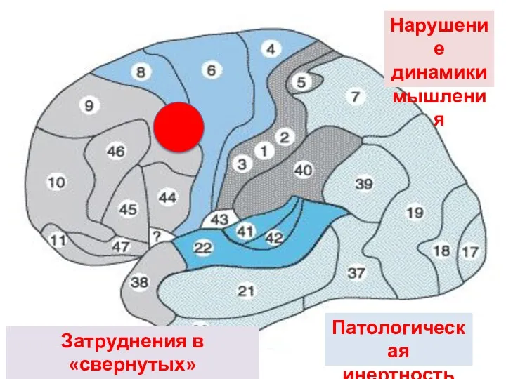 Нарушение динамики мышления Затруднения в «свернутых» умственных действиях Патологическая инертность