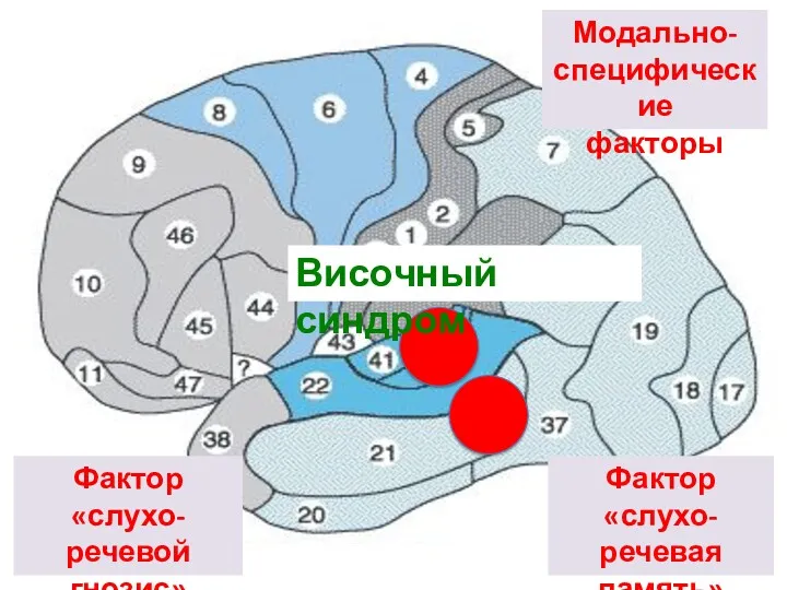 Модально- специфические факторы Фактор «слухо-речевая память» Фактор «слухо-речевой гнозис» Височный синдром