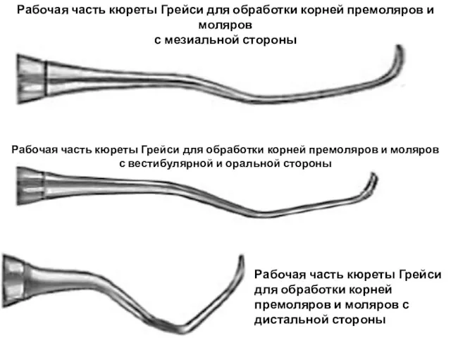 Рабочая часть кюреты Грейси для обработки корней премоляров и моляров