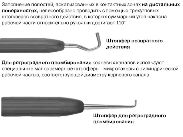 Заполнение полостей, локализованных в контактных зонах на дистальных поверхностях, целесообразно