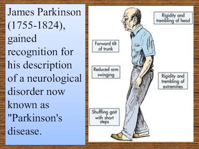 James Parkinson (1755-1824), gained recognition for his description of a neurological disorder now