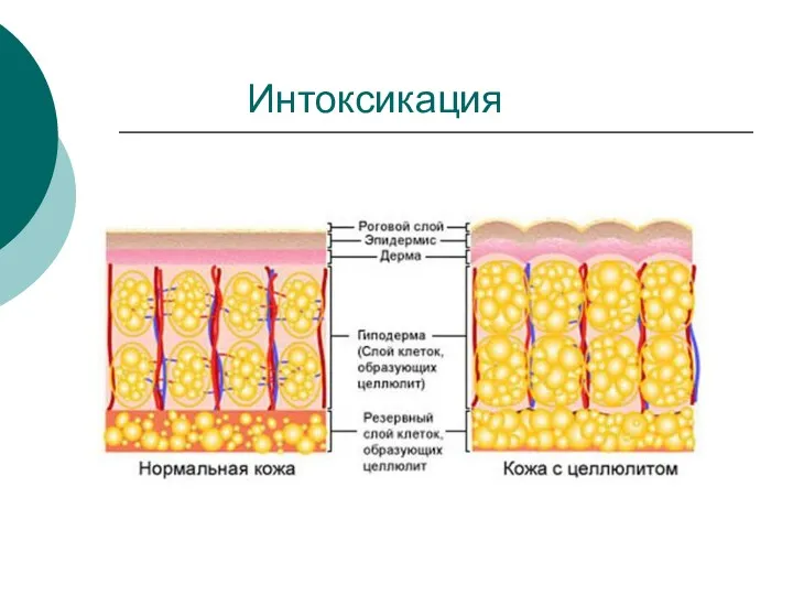 Интоксикация