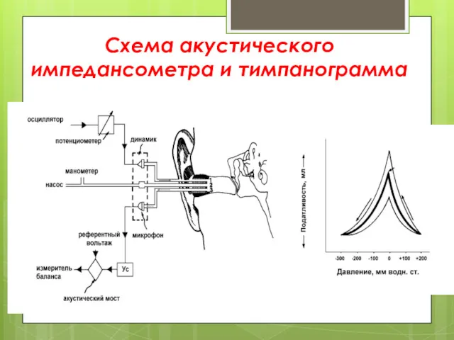 Схема акустического импедансометра и тимпанограмма