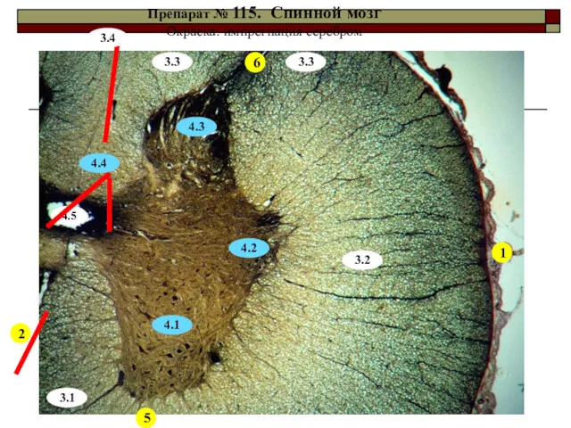 Препарат № 115. Спинной мозг Окраска: импрегнация серебром 1 4.5