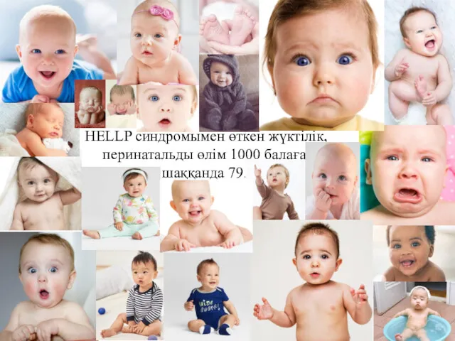 HELLP синдромымен өткен жүктілік, перинатальды өлім 1000 балаға шаққанда 79.