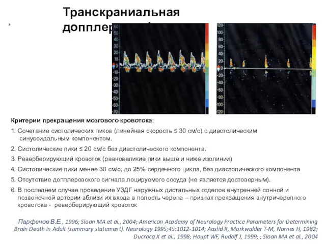 Транскраниальная допплерография Критерии прекращения мозгового кровотока: 1. Сочетание систолических пиков (линейная скорость ≤