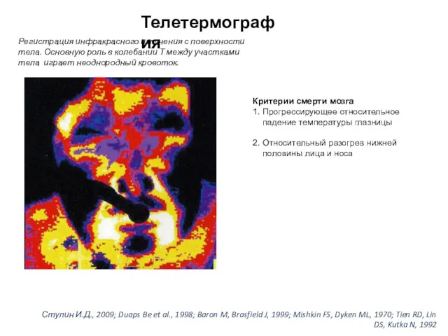 Телетермография Регистрация инфракрасного излучения с поверхности тела. Основную роль в колебании Т между