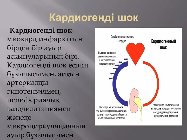 Кардиогенді шок Кардиогенді шок- миокард инфаркттың бірден бір ауыр асқынуларының