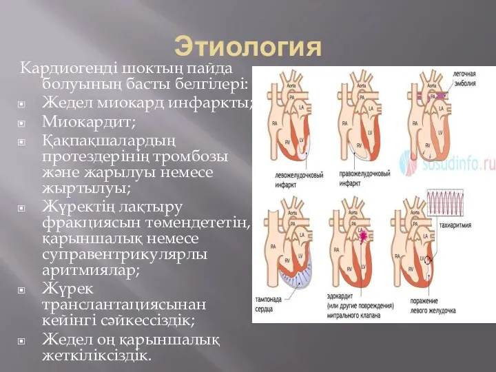 Этиология Кардиогенді шоктың пайда болуының басты белгілері: Жедел миокард инфаркты;