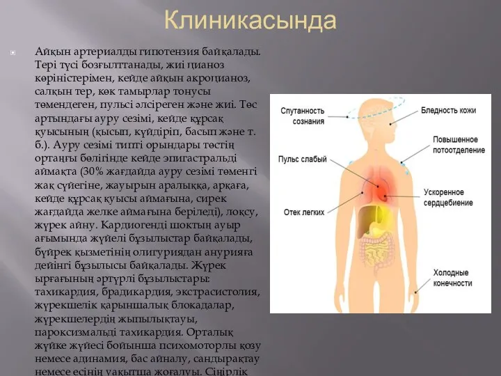 Клиникасында Айқын артериалды гипотензия байқалады. Тері түсі бозғылттанады, жиі цианоз