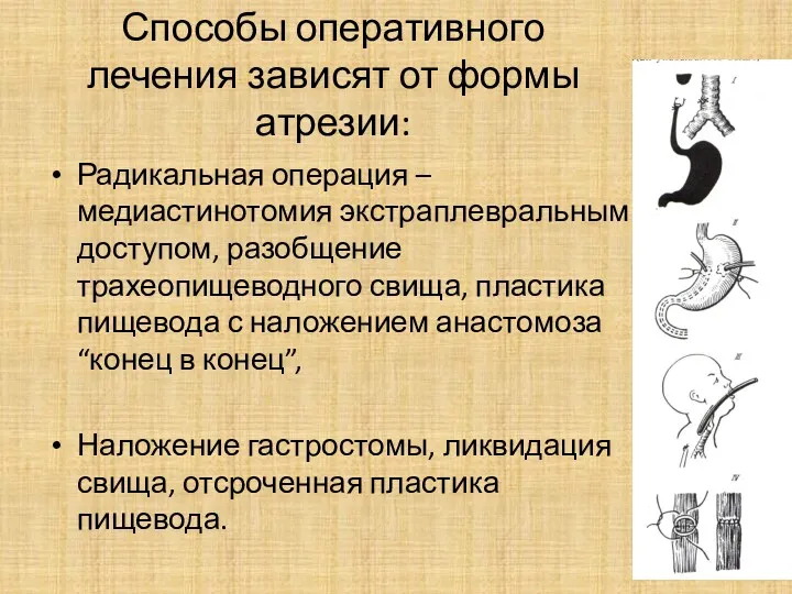 Способы оперативного лечения зависят от формы атрезии: Радикальная операция –