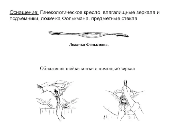 Оснащение: Гинекологическое кресло, влагалищные зеркала и подъемники, ложечка Фолькмана. предметные стекла Ложечка Фолькмана.