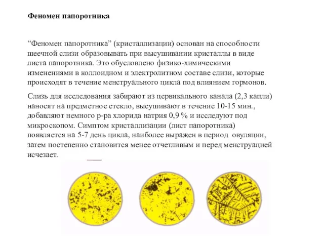 Феномен папоротника “Феномен папоротника” (кристаллизации) основан на способности шеечной слизи образовывать при высушивании