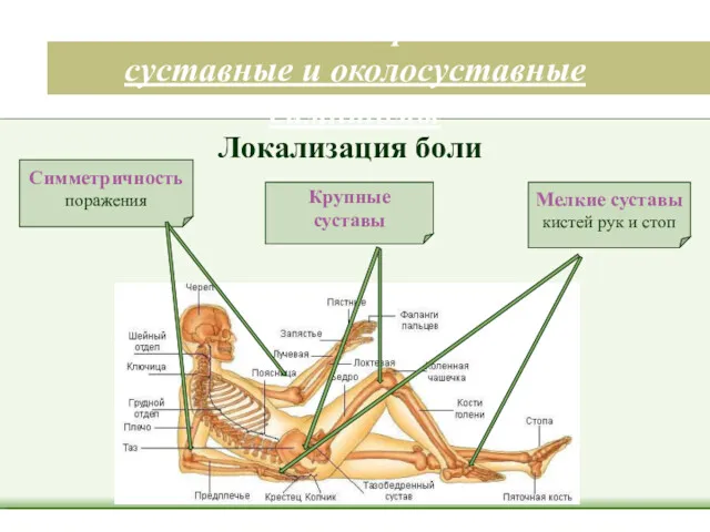 Клинические признаки – суставные и околосуставные симптомы Мелкие суставы кистей