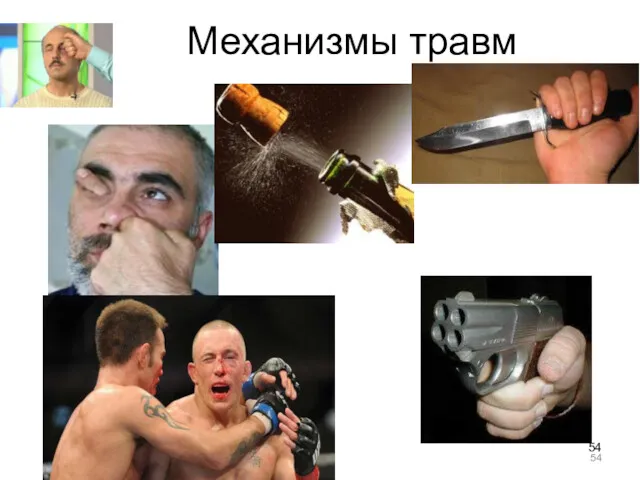 Механизмы травм