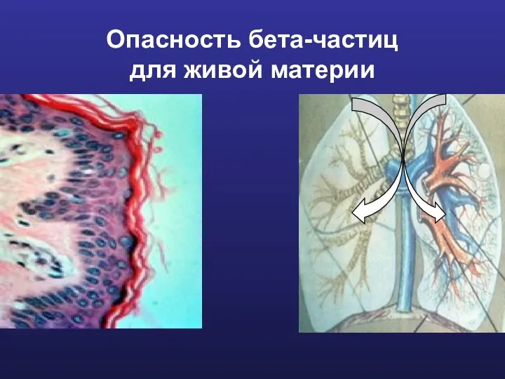 Опасность бета-частиц для живой материи