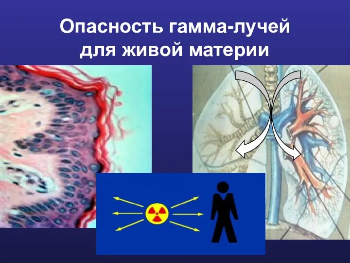 Опасность гамма-лучей для живой материи