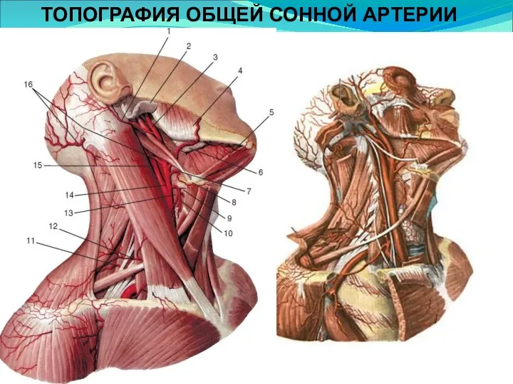 ТОПОГРАФИЯ ОБЩЕЙ СОННОЙ АРТЕРИИ