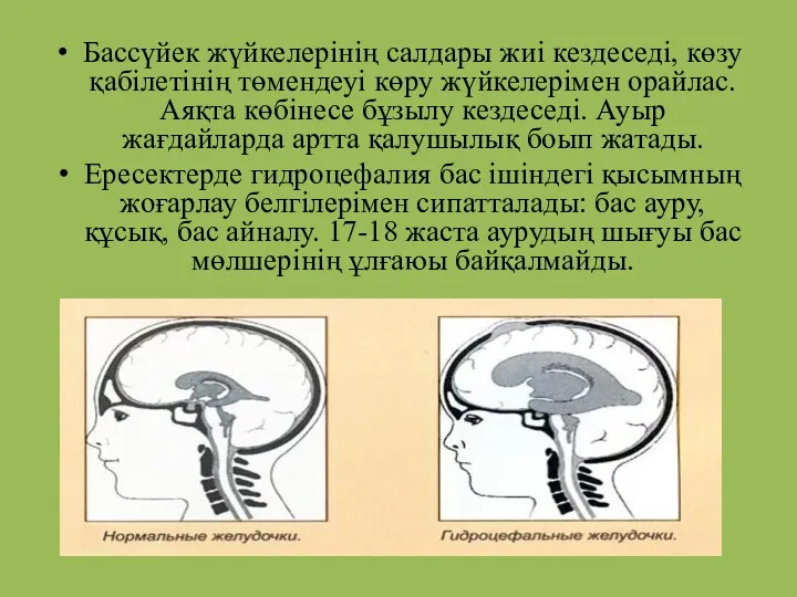 Бассүйек жүйкелерінің салдары жиі кездеседі, көзу қабілетінің төмендеуі көру жүйкелерімен