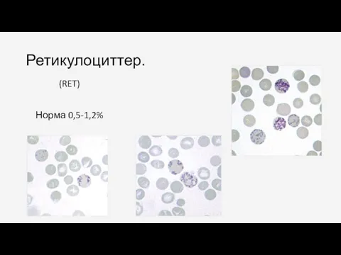 Ретикулоциттер. (RET) Норма 0,5-1,2%