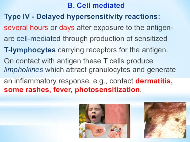 B. Cell mediated Type IV - Delayed hypersensitivity reactions: several