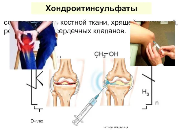 Хондроитинсульфаты составная часть костной ткани, хрящей, сухожилий, роговицы глаз, сердечных клапанов.