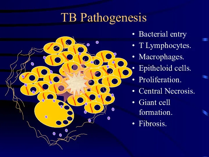 TB Pathogenesis Bacterial entry T Lymphocytes. Macrophages. Epitheloid cells. Proliferation. Central Necrosis. Giant cell formation. Fibrosis.