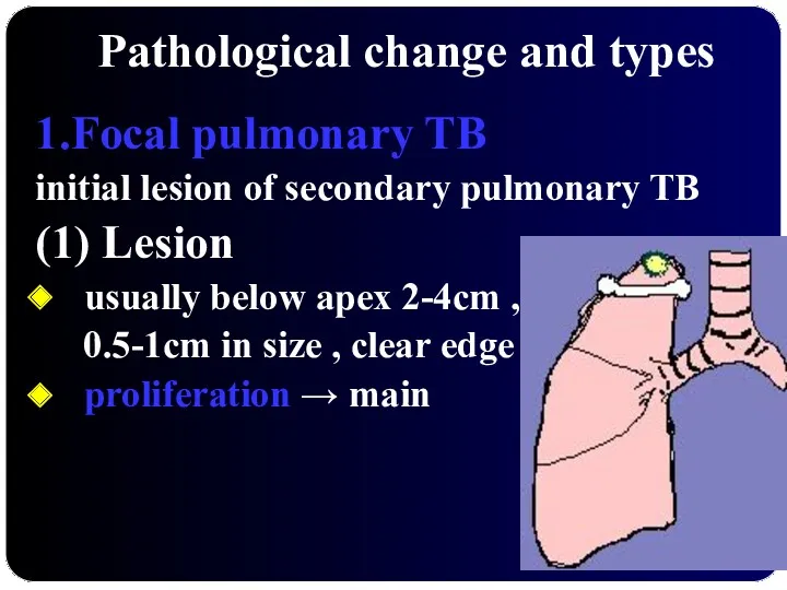 Pathological change and types 1.Focal pulmonary TB initial lesion of