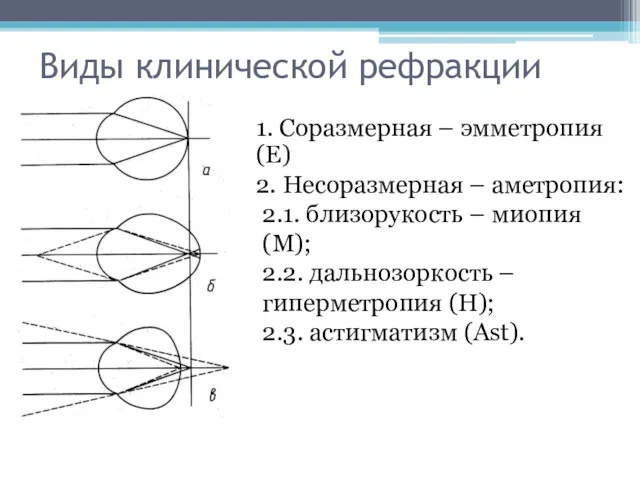 Виды клинической рефракции 1. Соразмерная – эмметропия (Е) 2. Несоразмерная