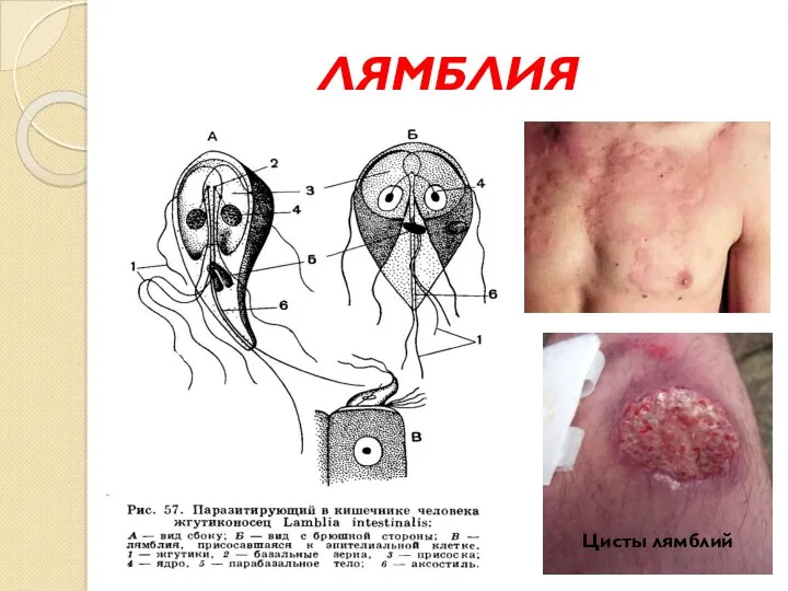 ЛЯМБЛИЯ Цисты лямблий