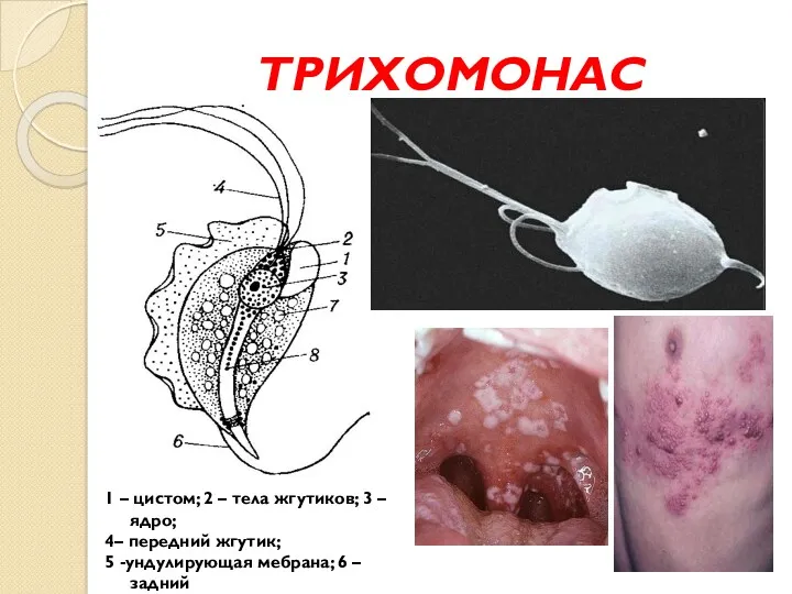 ТРИХОМОНАС 1 – цистом; 2 – тела жгутиков; 3 –