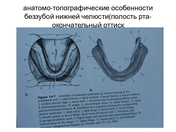 анатомо-топографические особенности беззубой нижней челюсти(полость рта- окончательный оттиск