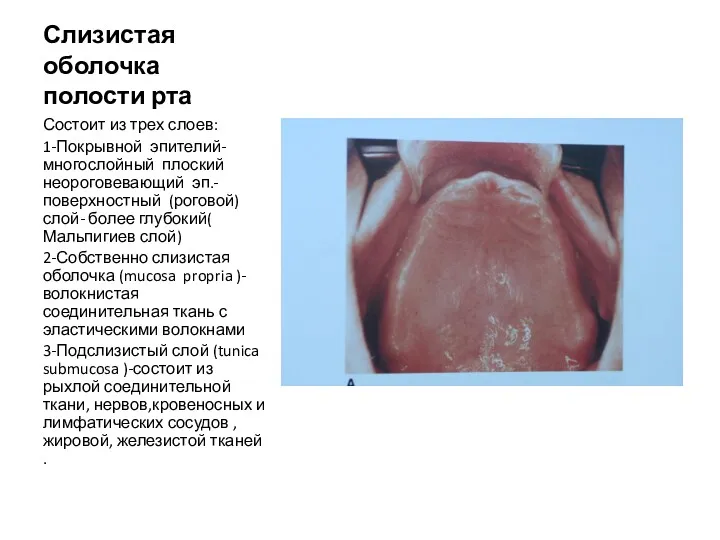 Слизистая оболочка полости рта Состоит из трех слоев: 1-Покрывной эпителий-многослойный