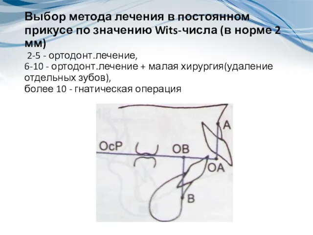 Выбор метода лечения в постоянном прикусе по значению Wits-числа (в