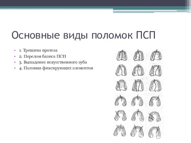 Основные виды поломок ПСП 1. Трещина протеза 2. Перелом базиса