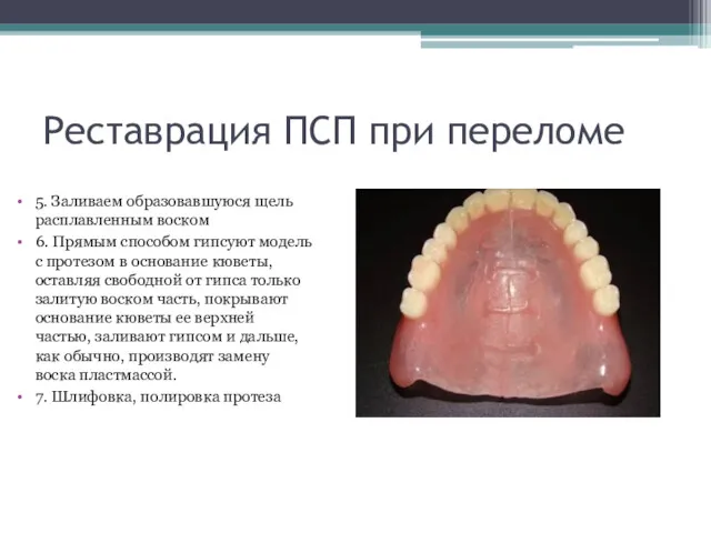 Реставрация ПСП при переломе 5. Заливаем образовавшуюся щель расплавленным воском