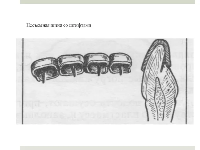 Несъемная шина со штифтами