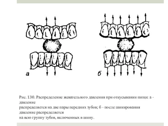 Рис. 130. Распределение жевательного давления при откусывании пищи: а -