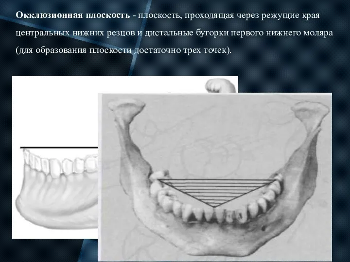 Окклюзионная плоскость - плоскость, проходящая через режущие края центральных нижних