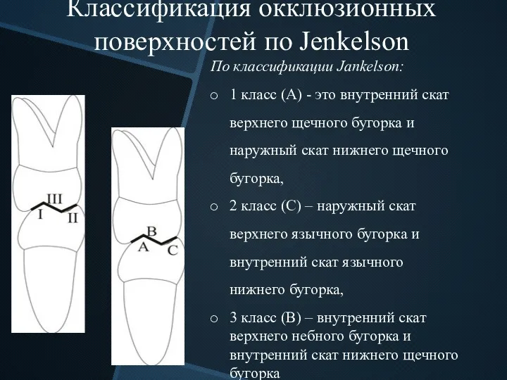 Классификация окклюзионных поверхностей по Jenkelson По классификации Jankelson: 1 класс