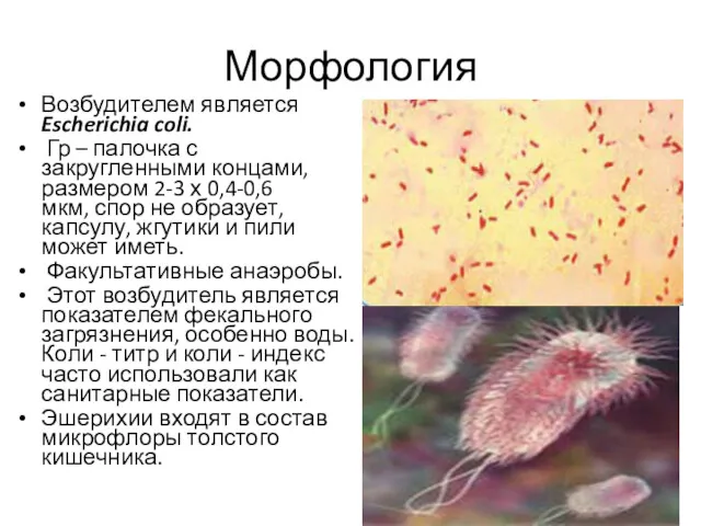 Морфология Возбудителем является Escherichia coli. Гр – палочка с закругленными