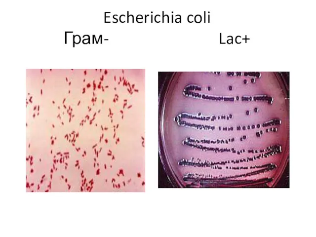 Escherichia coli Грам- Lac+