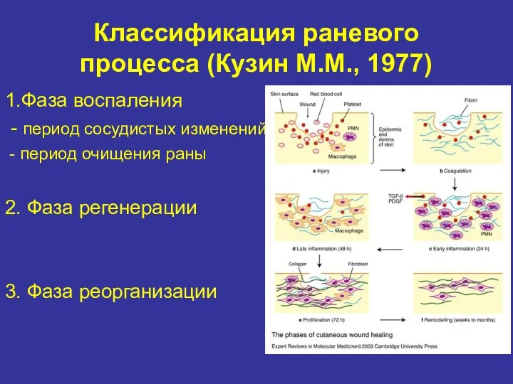 Классификация раневого процесса (Кузин М.М., 1977) 1.Фаза воспаления - период сосудистых изменений -