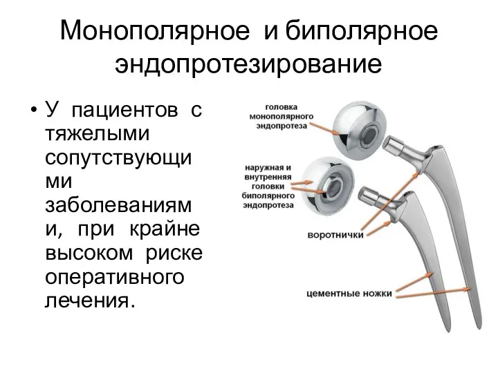 У пациентов с тяжелыми сопутствующими заболеваниями, при крайне высоком риске оперативного лечения. Монополярное и биполярное эндопротезирование