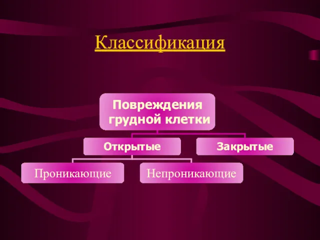 Классификация