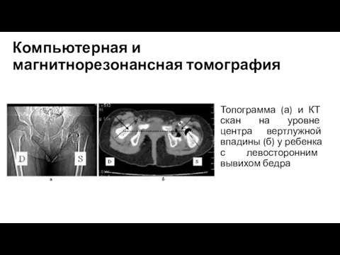 Компьютерная и магнитнорезонансная томография Топограмма (а) и КТ скан на
