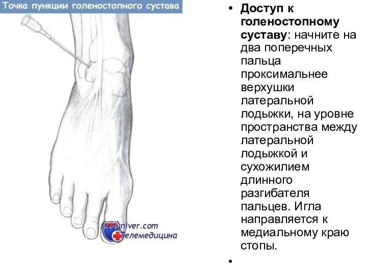 Доступ к голеностопному суставу: начните на два поперечных пальца проксимальнее