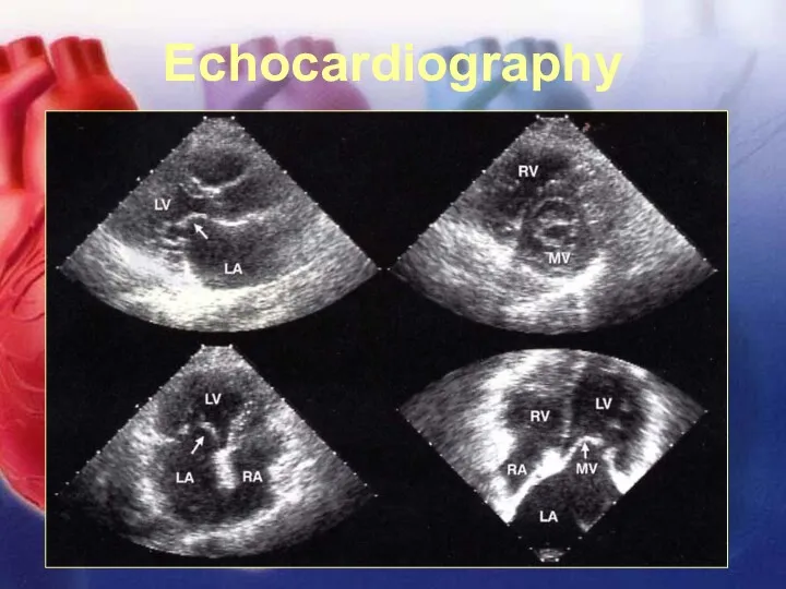 11/12/02 Lubna Piracha, D.O. Echocardiography