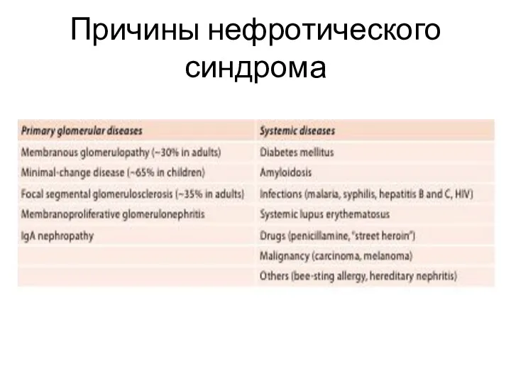 Причины нефротического синдрома